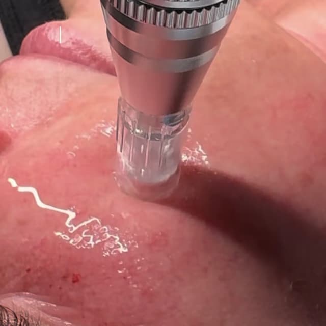 Total Skin Rebuild Ritual at CGL Beauty Co. in Addison, IL